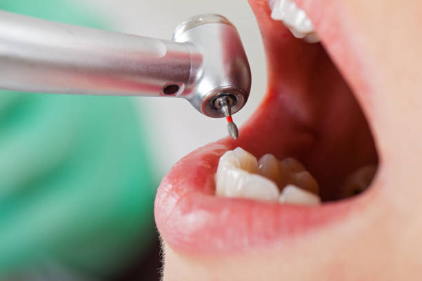 Best Orthodontic Emergency Dentist in Vian, OK